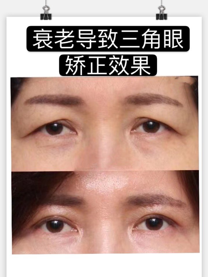 三角眼的人性情如何？面相看你的脸相