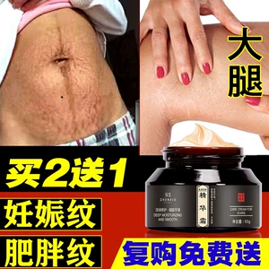 妊娠纹霜哪个牌子好？美腹邦告诉你怎么有效去纹